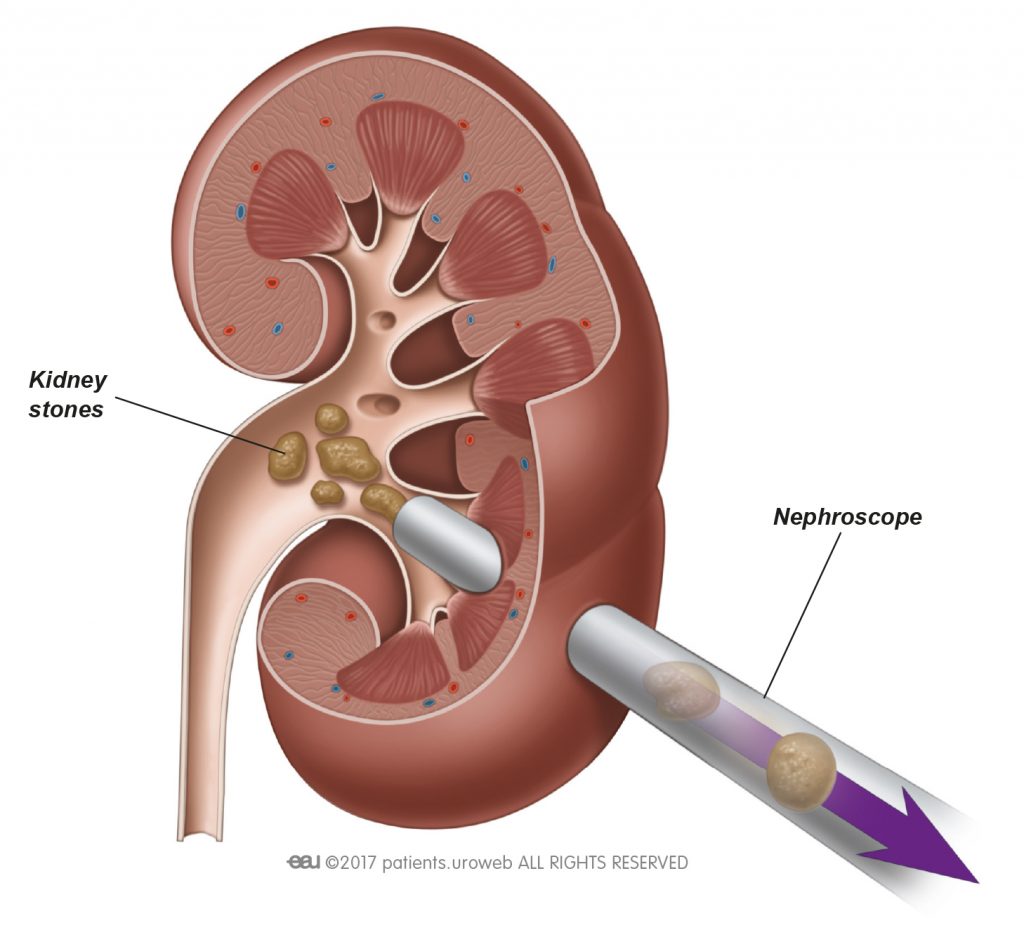 TULsurgery